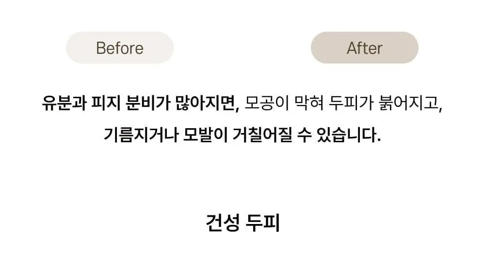 [탈모증상완화] 애쉬로렌 독일 맥주효모 샴푸&트리트먼트 500ml 2종 택1 상세페이지 5